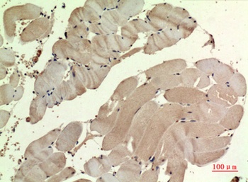 SDHB rabbit pAb Antibody