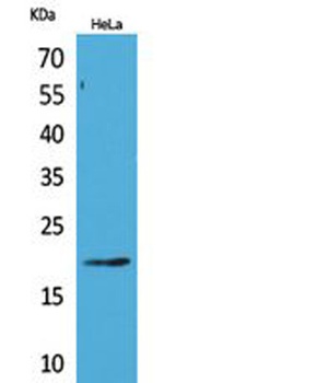 CD3-δ rabbit pAb Antibody