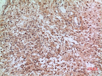 CD3-δ rabbit pAb Antibody