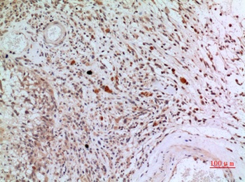 CD3-δ rabbit pAb Antibody