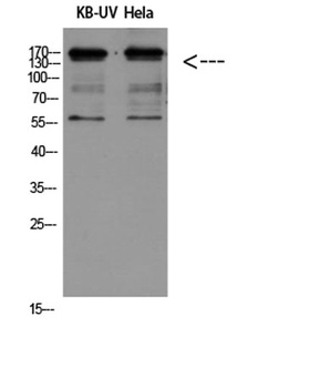 Integrin β2 rabbit pAb Antibody