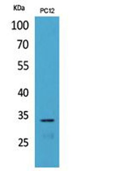 CD74 rabbit pAb Antibody