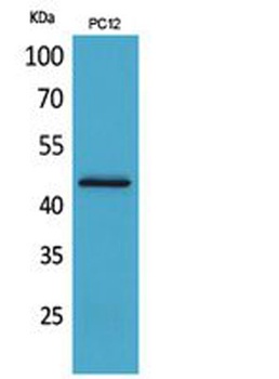 IL-1RII rabbit pAb Antibody