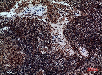 NKp44 rabbit pAb Antibody