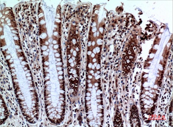 NKp44 rabbit pAb Antibody