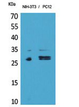 DcR1 rabbit pAb Antibody