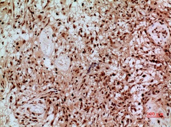 SAMHD1 rabbit pAb Antibody