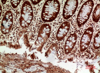 HLA-DQB1/2 rabbit pAb Antibody