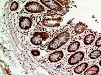 HLA-DQB1/2 rabbit pAb Antibody