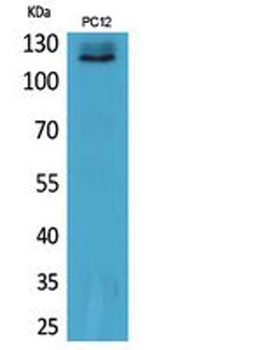 UBA1 rabbit pAb Antibody