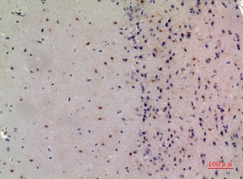 NCoA-3 rabbit pAb Antibody