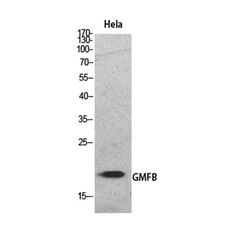 GMF-β rabbit pAb Antibody