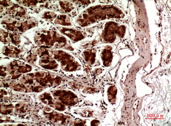 TERT rabbit pAb Antibody