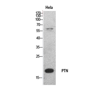 PTN rabbit pAb Antibody