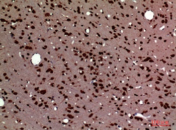 PTN rabbit pAb Antibody
