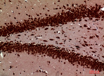PTN rabbit pAb Antibody