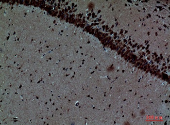 PTN rabbit pAb Antibody