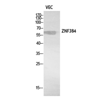 ZNF384 rabbit pAb Antibody