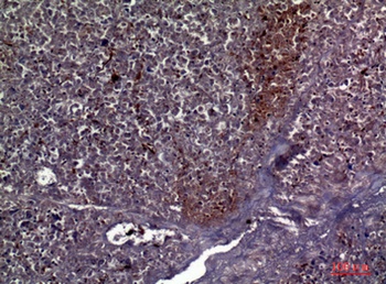 COL5A2 rabbit pAb Antibody