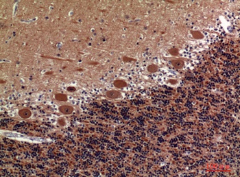 COL5A2 rabbit pAb Antibody