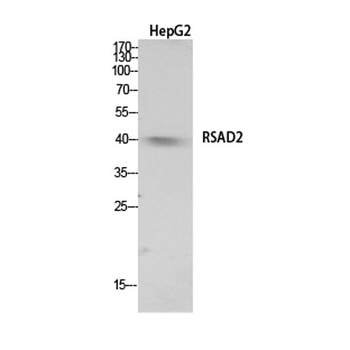 RSAD2 rabbit pAb Antibody