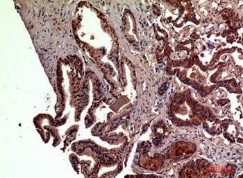 RSAD2 rabbit pAb Antibody
