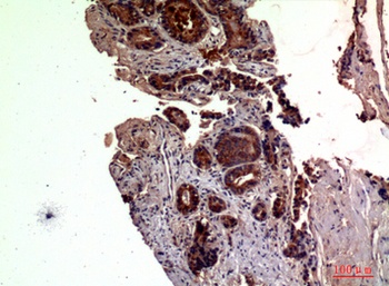 RSAD2 rabbit pAb Antibody
