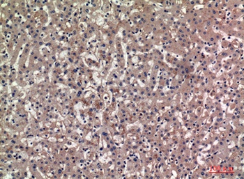 Bag-3 rabbit pAb Antibody