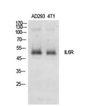 IL-6Rα rabbit pAb Antibody