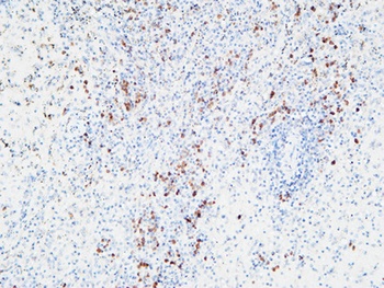 IL-6Rα rabbit pAb Antibody