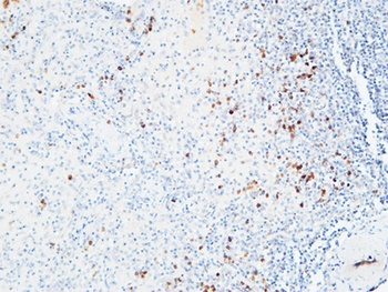 IL-6Rα rabbit pAb Antibody