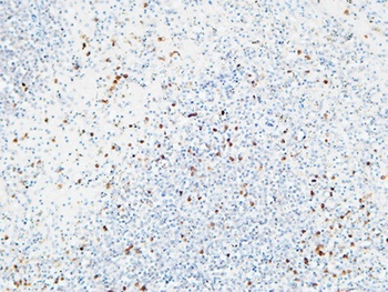 IL-6Rα rabbit pAb Antibody