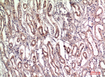 Tenascin-C rabbit pAb Antibody