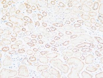 Tenascin-C rabbit pAb Antibody