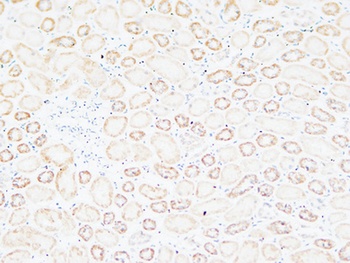 Tenascin-C rabbit pAb Antibody