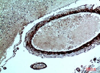 FGF-17 rabbit pAb Antibody