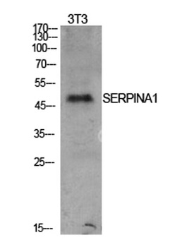 AAT rabbit pAb Antibody