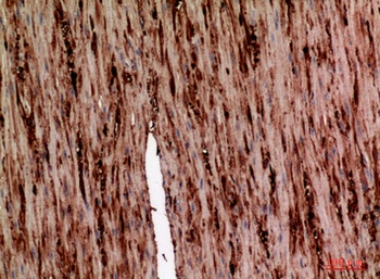 AAT rabbit pAb Antibody