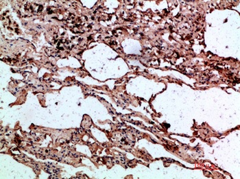 AAT rabbit pAb Antibody