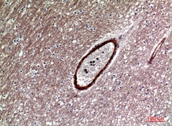 Dkk-1 rabbit pAb Antibody