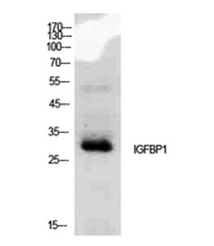 IGFBP1 rabbit pAb Antibody