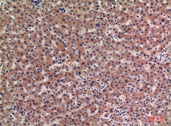 IGFBP1 rabbit pAb Antibody