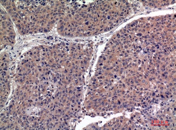 IGFBP1 rabbit pAb Antibody