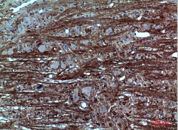 GABAA Rα1 rabbit pAb Antibody