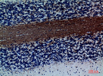 GABAA Rα1 rabbit pAb Antibody