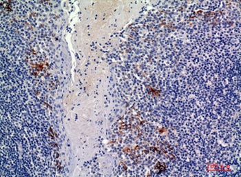 CD19 rabbit pAb Antibody