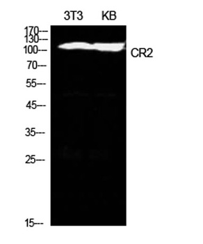 CD21 rabbit pAb Antibody