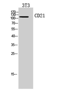 CD21 rabbit pAb Antibody