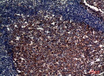 CD21 rabbit pAb Antibody