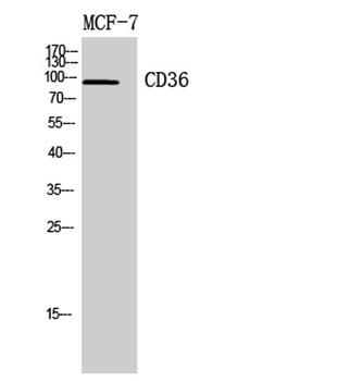 CD36 rabbit pAb Antibody